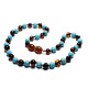 Polished Baroque Style Dark Cognac Baltic Amber With Turquoise Teething Necklace