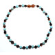 Polished Baroque Style Dark Cognac Baltic Amber With Turquoise Teething Necklace