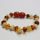 Polished Baroque Style Milky/Cognac Baltic Amber Teething Bracelet/Anklet